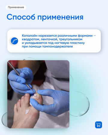 Копалайн (1,4*10м) Владмива